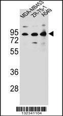 Anti-CTTNBP2NL Rabbit Polyclonal Antibody