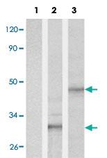 Anti-His tag Polyclonal Antibody