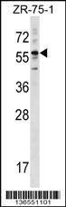 Anti-KRT3 Rabbit Polyclonal Antibody