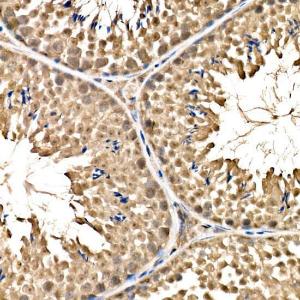 Immunohistochemistry analysis of paraffin-embedded mouse testis using Anti-Parkin Antibody (A12727) at a dilution of 1:200 (40x lens). Perform high pressure antigen retrieval with 10 mM citrate buffer pH 6.0 before commencing with IHC staining protocol.