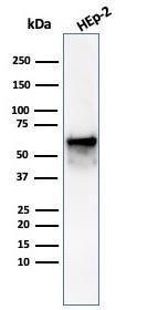 Western blot analysis of Hep2 cell line lysate using Anti-HSP60 Antibody [rHSPD1/6497]