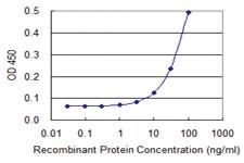 Anti-MYL9 Mouse Monoclonal Antibody [clone: 3F2]