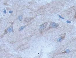 Anti-DICER1 Rabbit Polyclonal Antibody