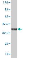 Anti-NEUROG1 Mouse Monoclonal Antibody [clone: 4G10]