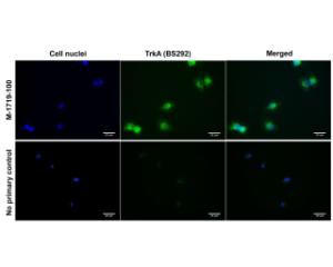 Immunofluorescence analysis of TrkA expression in human DU145 prostate cancer cells.