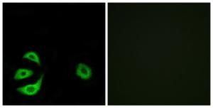 Immunofluorescence analysis of A549 cells using Anti-ACOT8 Antibody. The right hand panel represents a negative control, where the Antibody was pre-incubated with the immunising peptide