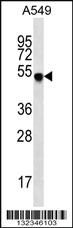 Anti-FGFRL1 Rabbit Polyclonal Antibody