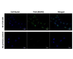 Immunofluorescence analysis of TrkA expression in human SH-SY5Y cells.