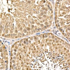 Immunohistochemistry analysis of paraffin-embedded rat testis using Anti-Parkin Antibody (A12727) at a dilution of 1:200 (40x lens). Perform high pressure antigen retrieval with 10 mM citrate buffer pH 6.0 before commencing with IHC staining protocol.