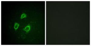 Immunofluorescence analysis of HepG2 cells using Anti-KCNB1 (phospho Ser567) Antibody. The right hand panel represents a negative control, where the antibody was pre-incubated with the immunising peptide