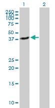 Anti-QPCT Mouse Polyclonal Antibody