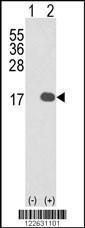 Anti-IL36B Rabbit Polyclonal Antibody (APC (Allophycocyanin))