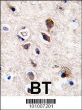 Anti-PRKCG Rabbit Polyclonal Antibody (Biotin)