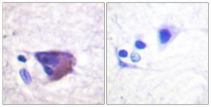 Immunohistochemical analysis of paraffin-embedded human brain using Anti-KCNB1 (phospho Ser567) Antibody. The right hand panel represents a negative control, where the antibody was pre-incubated with the immunising peptide