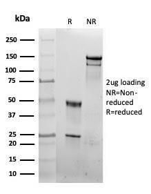 SDS-PAGE analysis of Anti-HSP60 Antibody [rHSPD1/6497] under non-reduced and reduced conditions; showing intact IgG and intact heavy and light chains, respectively. SDS-PAGE analysis confirms the integrity and purity of the antibody