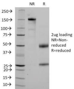 SDS-PAGE analysis of Anti-CD36 Antibody [1A7] under non-reduced and reduced conditions; showing intact IgG and intact heavy and light chains, respectively. SDS-PAGE analysis confirms the integrity and purity of the antibody