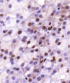 Anti-c11ORF59/LAMTOR1 Rabbit Polyclonal Antibody