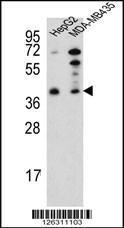 Anti-PARP16 Rabbit Polyclonal Antibody (APC (Allophycocyanin))