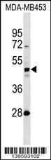 Anti-KRT31 Rabbit Polyclonal Antibody (APC (Allophycocyanin))