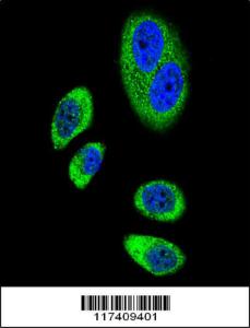 Anti-PTGS2 Rabbit Polyclonal Antibody (HRP (Horseradish Peroxidase))