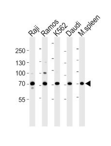 Anti-BTK Rabbit Polyclonal Antibody