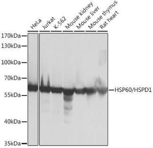 Western blot analysis of extracts of various cell lines, using Anti-HSP60 Antibody (A12728) at 1:1,000 dilution