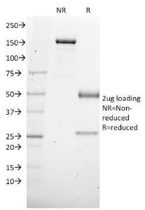 SDS-PAGE analysis of Anti-SOX4 Antibody [SOX4/2540] under non-reduced and reduced conditions; showing intact IgG and intact heavy and light chains, respectively. SDS-PAGE analysis confirms the integrity and purity of the antibody