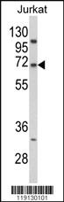 Anti-STAT2 Rabbit Polyclonal Antibody