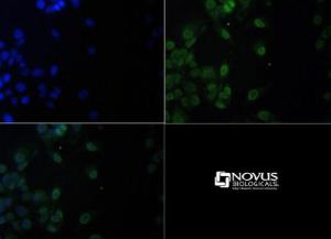 Anti-c11ORF59/LAMTOR1 Rabbit Polyclonal Antibody