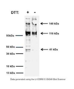 Western blot of TrkA in rat PC12 cell lysates (30 μg/lane). M-1719-100 detects TrkA full-length protein at ≈ 140 kD, an isoform of glycosylated TrkA at 110 kDa and a intracellular cleavage product at 41 kDa (see Cabrera et al., 1995; Rossi et al., 2002).