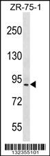 Anti-HRC Rabbit Polyclonal Antibody