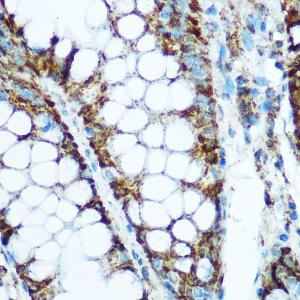 Immunohistochemistry analysis of paraffin-embedded human colon tissue using Anti-HSP60 Antibody (A12728) at a dilution of 1:100 (40X lens). Perform microwave antigen retrieval with 10 mM Tris/EDTA buffer pH 9.0 before commencing with IHC staining protocol