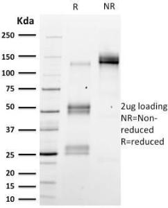 SDS-PAGE analysis of Anti-Emerin Antibody [EMD/2167] under non-reduced and reduced conditions; showing intact IgG and intact heavy and light chains, respectively. SDS-PAGE analysis confirms the integrity and purity of the antibody