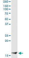 Anti-MGST2 Antibody Pair