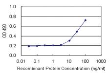 Anti-S100 A2 Antibody Pair