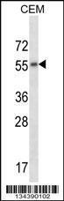 Anti-CHRM2 Rabbit Polyclonal Antibody (AP (Alkaline Phosphatase))