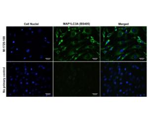 Immunofluorescence analysis of MAP1LC3A expression in rat C6 glioma cells.