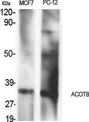 Western blot analysis of various cells using Anti-ACOT8 Antibody