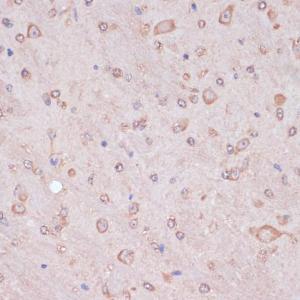 Immunohistochemistry analysis of paraffin-embedded mouse brain using Anti-CART Antibody (A305732) at a dilution of 1:100 (40X lens). Perform microwave antigen retrieval with 10 mM PBS buffer pH 7.2 before commencing with IHC staining protocol