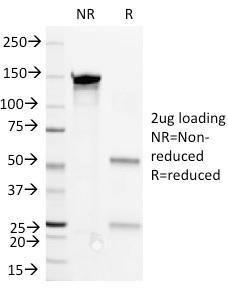 Anti-CD36 Mouse Monoclonal Antibody [Clone: 1E8]