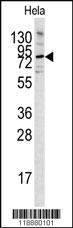 Anti-PCSK9 Rabbit Polyclonal Antibody