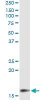 Anti-MGST2 Antibody Pair