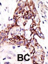 Anti-ARL3 Rabbit Polyclonal Antibody (HRP (Horseradish Peroxidase))