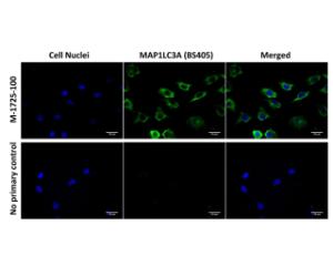 Immunofluorescence analysis of MAP1LC3A expression in human SH-SY5Y cells.