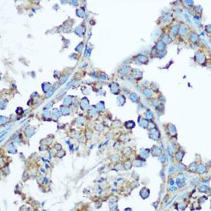 Immunohistochemistry analysis of paraffin-embedded mouse testis using Anti-HSP60 Antibody (A12728) at a dilution of 1:100 (40X lens). Perform microwave antigen retrieval with 10 mM Tris/EDTA buffer pH 9.0 before commencing with IHC staining protocol