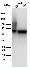 Western blot analysis of (Lane 1) Hep2 cell line lysate and (Lane 2) HeLa cell line lysate using Anti-HSP60 Antibody [rHSPD1/6497]