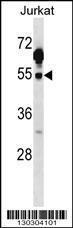 Anti-CSK Rabbit Polyclonal Antibody (HRP (Horseradish Peroxidase))