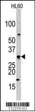 Anti-CDCA8 Rabbit Polyclonal Antibody (AP (Alkaline Phosphatase))