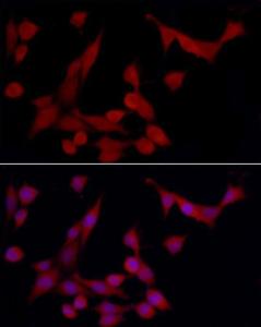 Immunofluorescence analysis of PC-12 using Anti-Heme Oxygenase 1 Antibody (A307279) at dilution of 1 : 50 (40X lens). DAPI was used to stain the cell nuclei (blue)