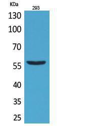 Western blot analysis of 293 cells using Anti-CD276 Antibody